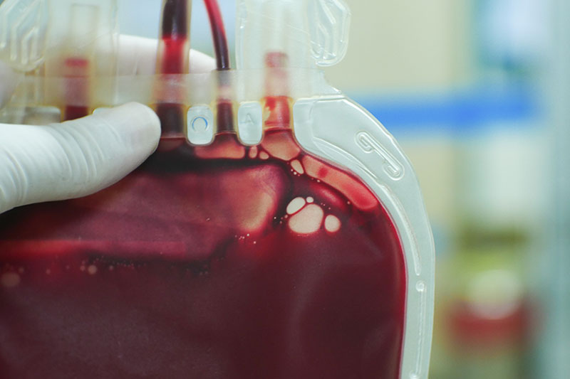 Blood bag in hospital laboratory
